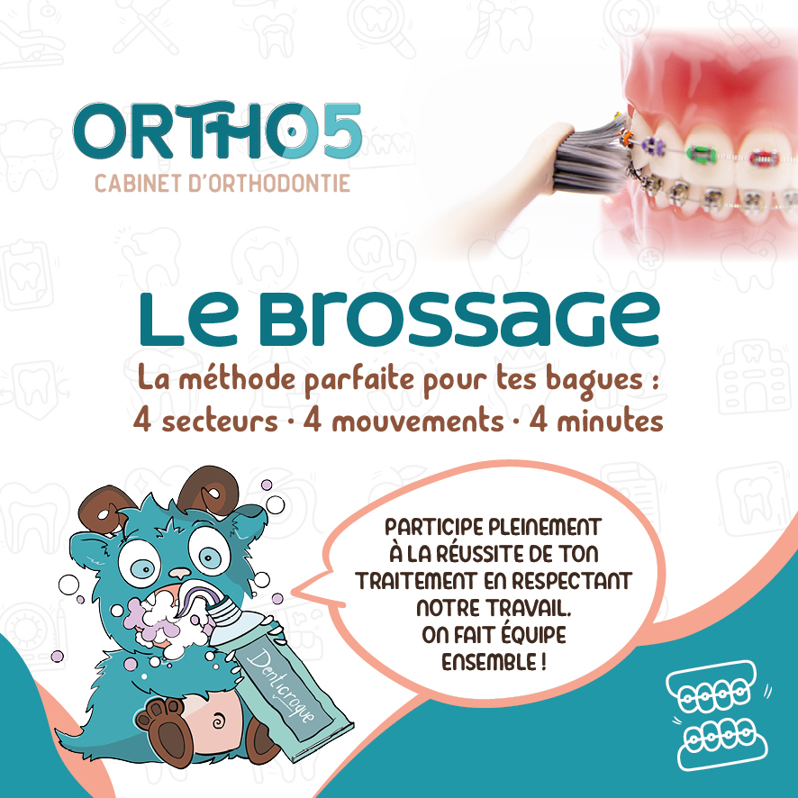 conseils brossage bagues dentaires