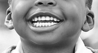 orthodontiste enfant embrun ortho5